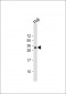 HLA-DQA1 Antibody (N-term)